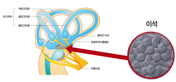 1.png 세반고리관